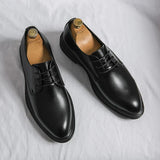 Sterling | Polished Lace-Up Derby Shoes